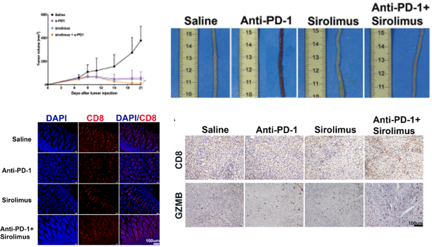 Sirolimus能够协同PD-1发挥抗肿瘤作用.png